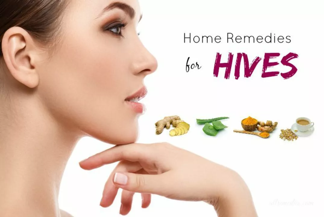 Natural Treatments for Hives: Are They Effective?